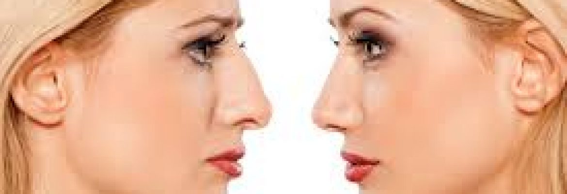 Rhinoplasty in Dubai