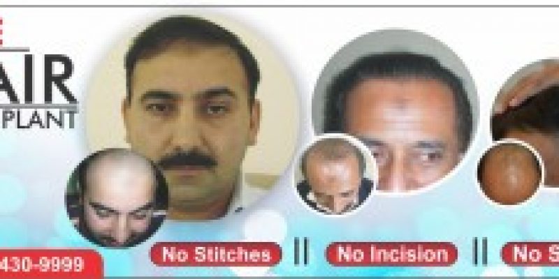 Fue Hair Transplant Clinic Pakistan Lahore