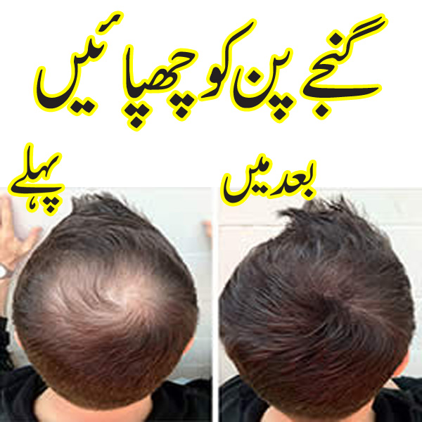 Caboki hair Fiber in Pakistan 03005854770 – Pakistan Places
