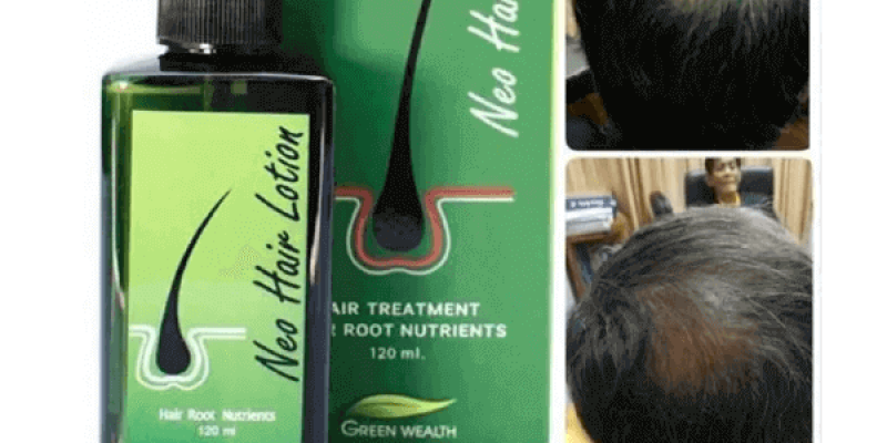 Neo Hair Lotion in Dera Ismail Khan – 03019628784 – Order Now
